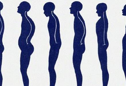 POSTURAL POSTURAL